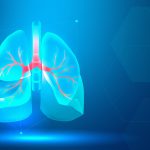 Lung Cancer Treatment Cost in India: Detailed Guide for Patients